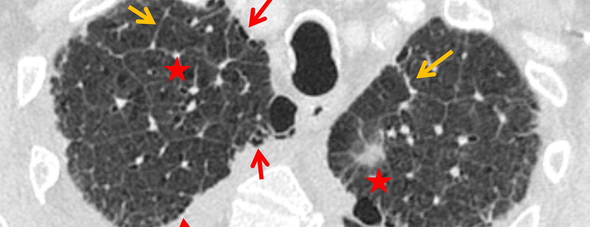 Publication image